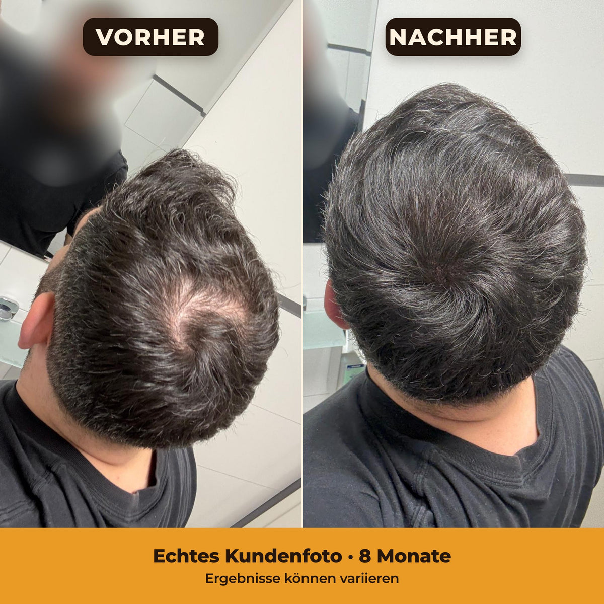 Echtes Kundenfoto vorher und nachher nach 8 Monaten